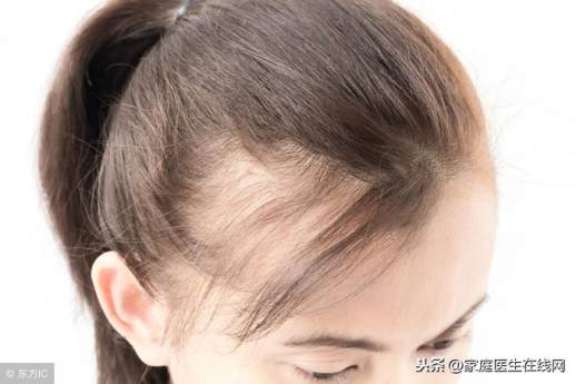 发际线高的人说明什么