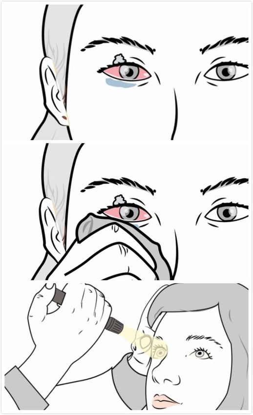 胶怎么去除_粘胶留下的痕迹怎么去除