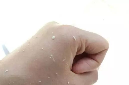 搓泥是什么意思_搓泥怎么办